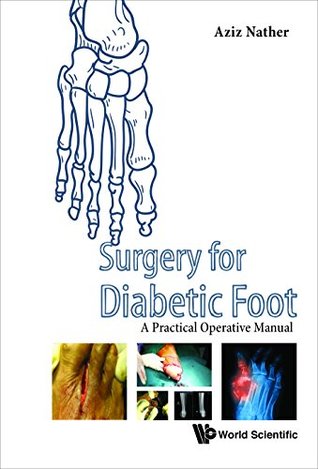 Full Download Surgery for Diabetic Foot:A Practical Operative Manual - Aziz Nather | PDF