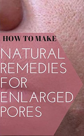 Read Online How To Make Natural Remedies For Enlarged Pores - Albet Wiliam | PDF